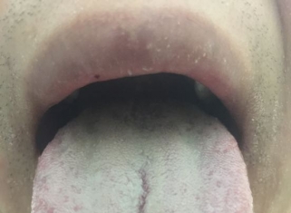 好几年了，不知道什么情况，