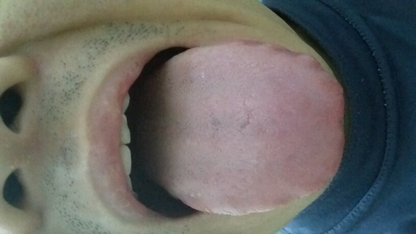 dzc1491403342933mjBLa_temp_1491403483260.jpg