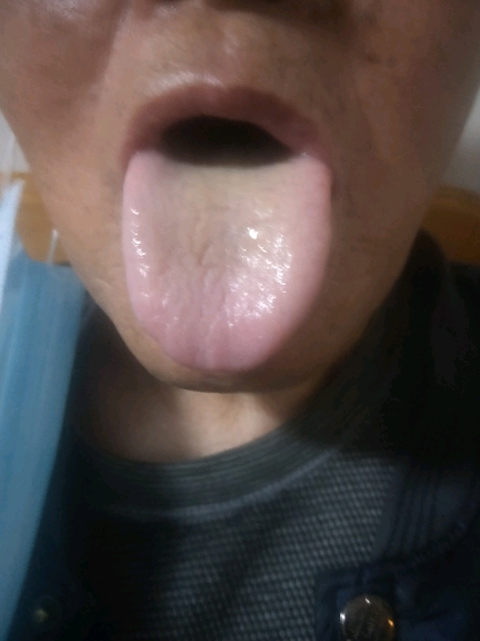 IMG20200324191443_1_temp_1585104241866.jpg